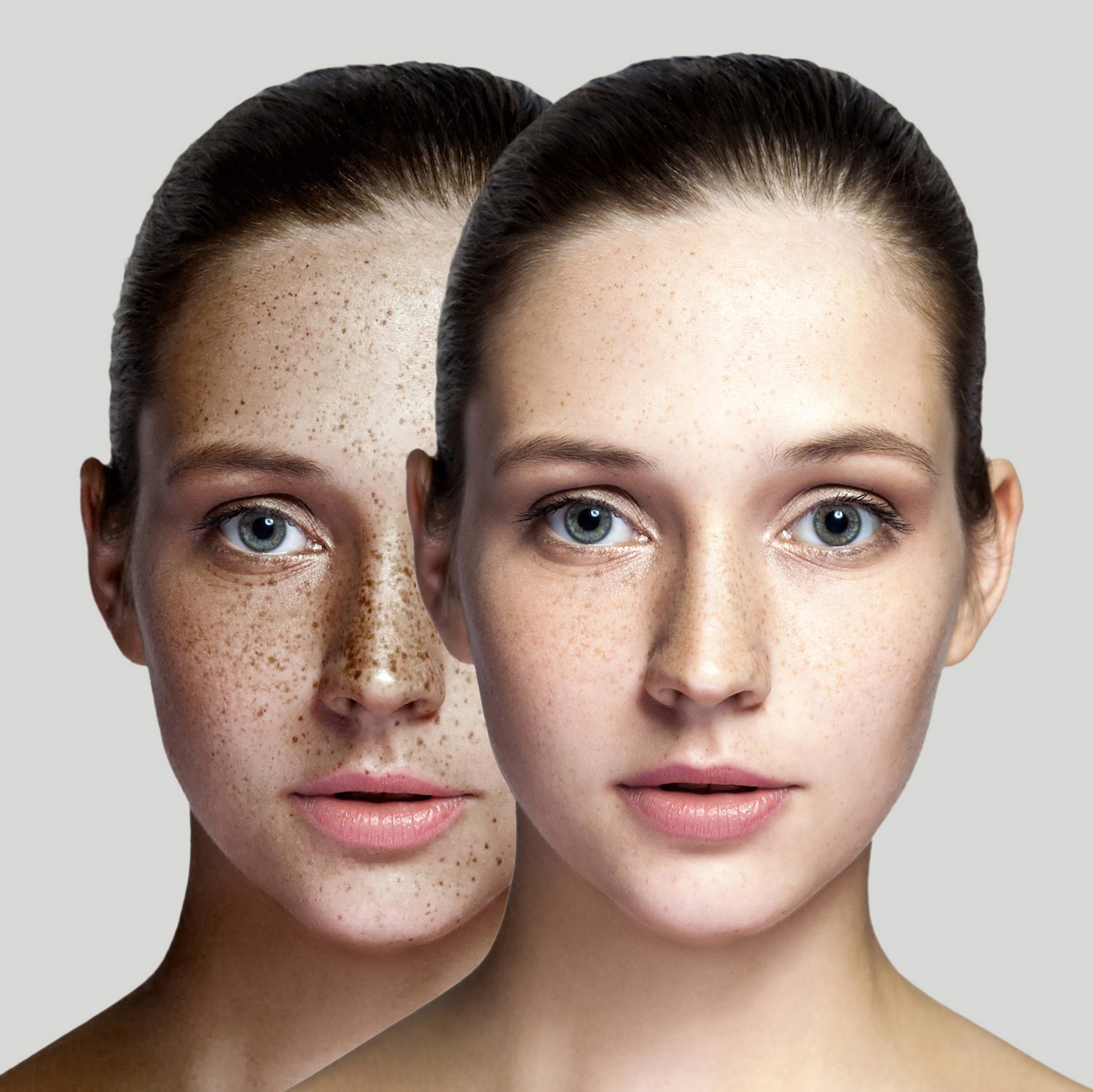 Formation Taches de Rousseur Freckles Face - Escale Beauty